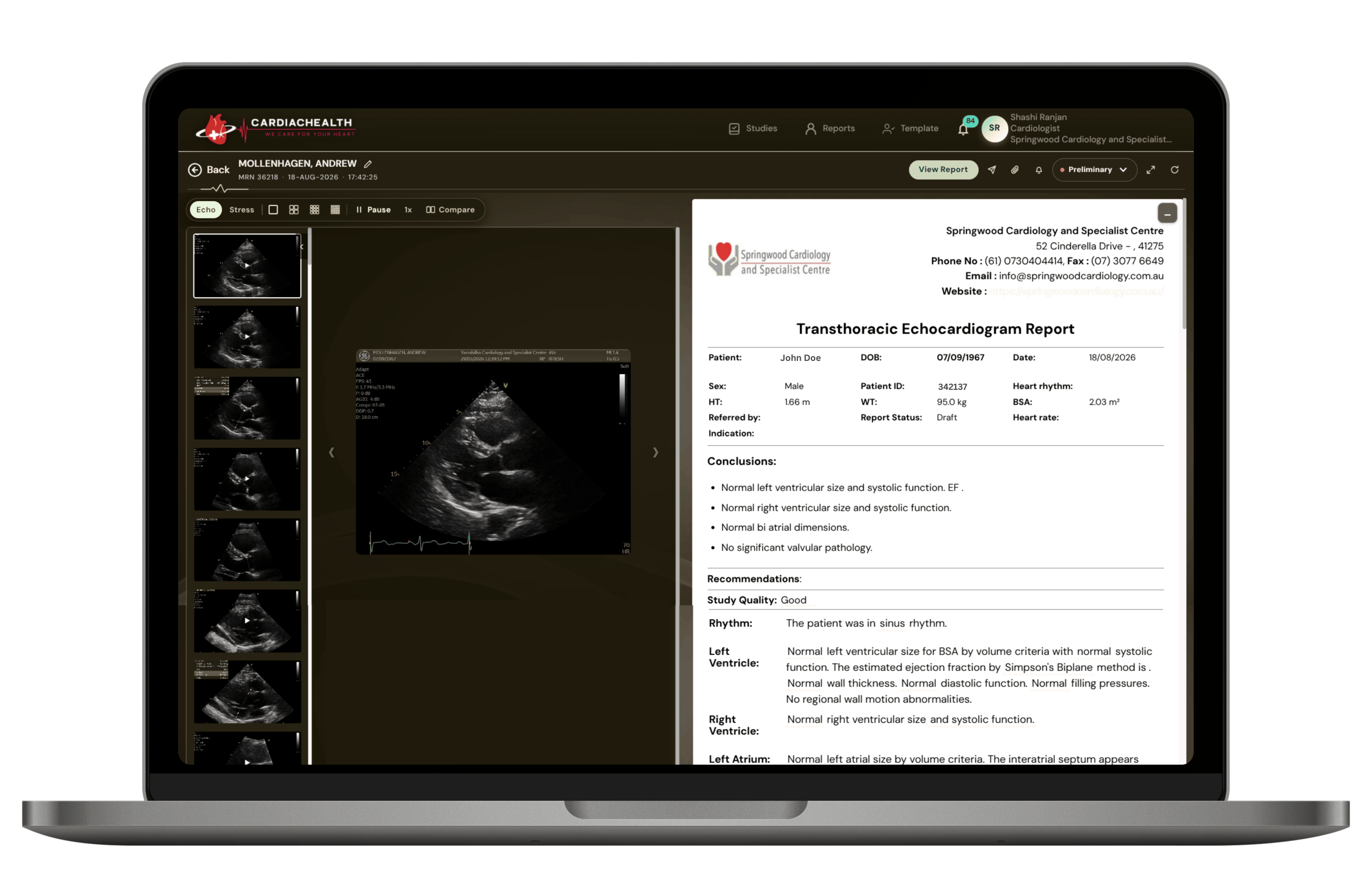 Generate Structured Report
