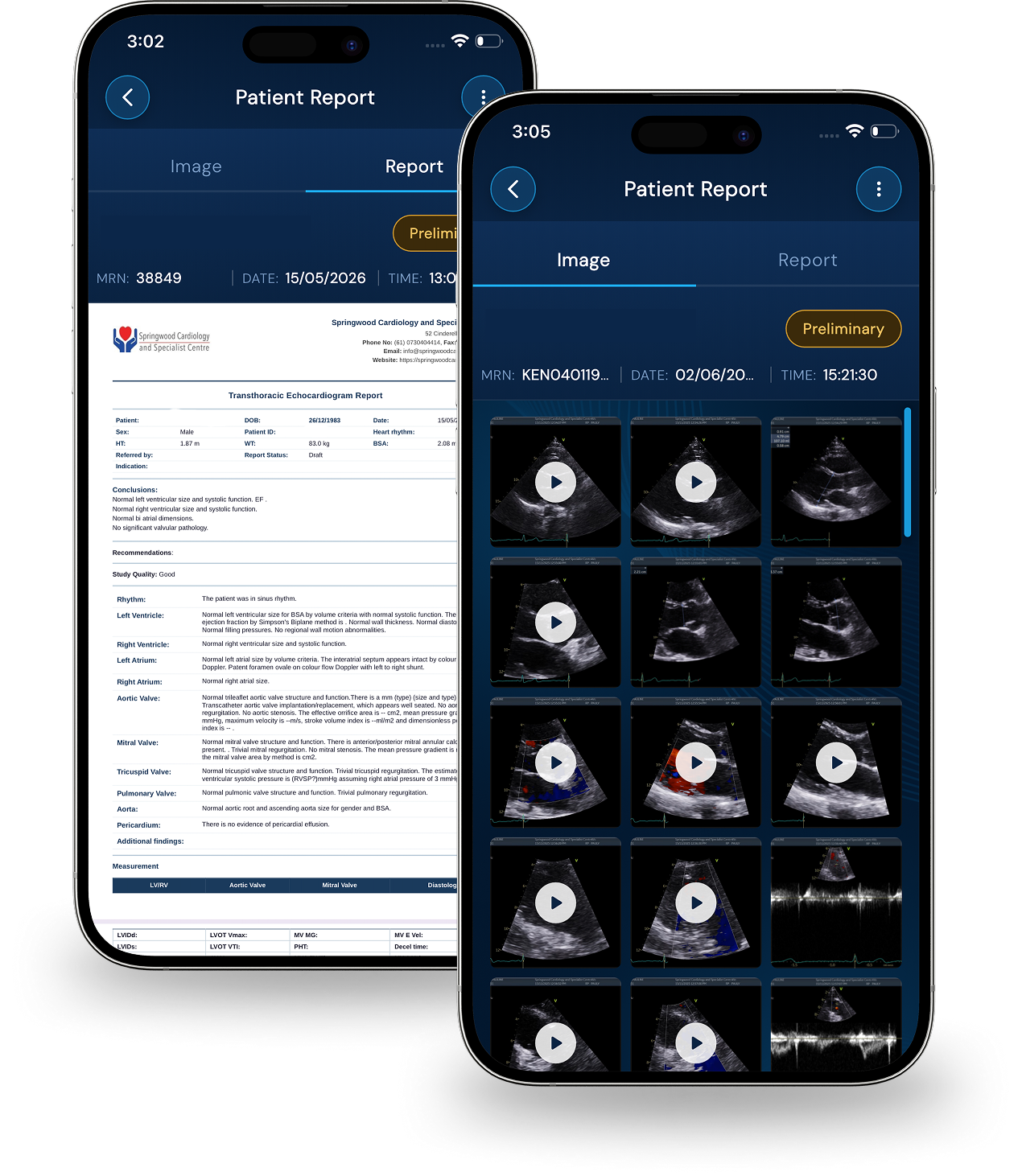 Mobile app screens